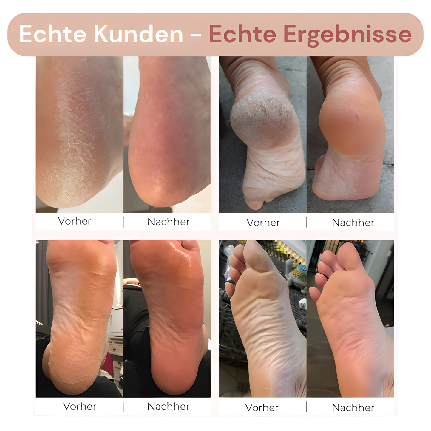 NUVELLE PureTouch®